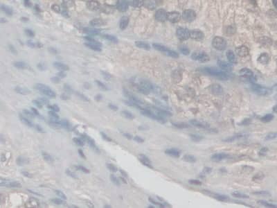 Immunohistochemistry-Paraffin: NOX5 Antibody [NBP3-42355] - DAB staining on fromalin fixed paraffin-embedded Kidney tissue