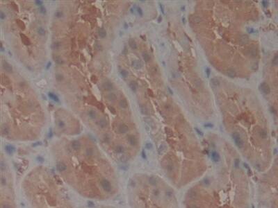 Immunohistochemistry-Paraffin: TEP1 Antibody [NBP3-42356] - DAB staining on IHC-P; Samples: Human Kidney Tissue; Primary Ab: 10ug/ml NBP3-42356; Second Ab: 2ug/mL HRP-Linked Caprine Anti-Rabbit IgG Polyclonal Antibody