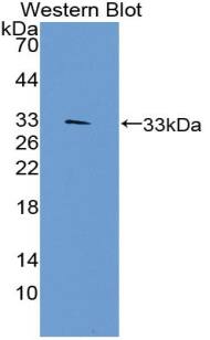 Western Blot: TEP1 Antibody [NBP3-42356] - Sample: Recombinant protein.