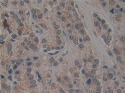 Immunohistochemistry-Paraffin: TEP1 Antibody [NBP3-42356] - DAB staining on fromalin fixed paraffin-embedded stomach tissue