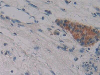 Immunohistochemistry-Paraffin: FBN3 Antibody [NBP3-42357] - DAB staining on fromalin fixed paraffin-embedded stomach tissue