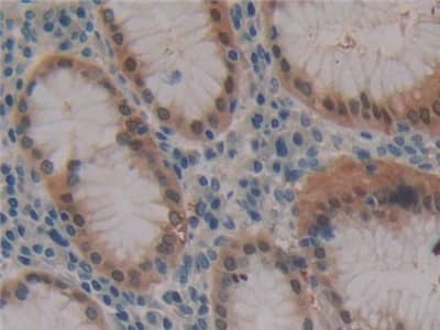 Immunohistochemistry-Paraffin: FBN3 Antibody [NBP3-42357] - DAB staining on IHC-P; Samples: Human Stomach Tissue; Primary Ab: 10ug/ml NBP3-42357; Second Ab: 2ug/mL HRP-Linked Caprine Anti-Rabbit IgG Polyclonal Antibody