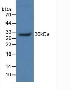 Western Blot: MUC17 Antibody [NBP3-42358] - Sample: Recombinant MUC17, Human.