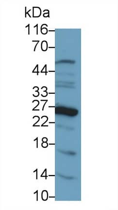 Western Blot: Galectin-14/LGALS14 Antibody [NBP3-42360] - Sample: Human Placenta lysate Primary Ab: 0.2ug/ml NBP3-42360; Second Ab: 0.2ug/mL HRP-Linked Caprine Anti-Rabbit IgG Polyclonal Antibody