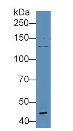 Western Blot: VWA3A Antibody [NBP3-42362] - Sample: Human Serum; Primary Ab: 5ug/ml NBP3-42362; Second Ab: 0.2ug/mL HRP-Linked Caprine Anti-Rabbit IgG Polyclonal Antibody