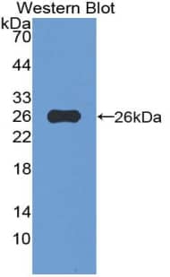 Western Blot: VWA3A Antibody [NBP3-42362] - Sample: Recombinant vWA3A, Human.
