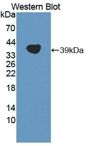 Western Blot: Lipoprotein a Antibody [NBP3-42363] - Sample: Recombinant protein.