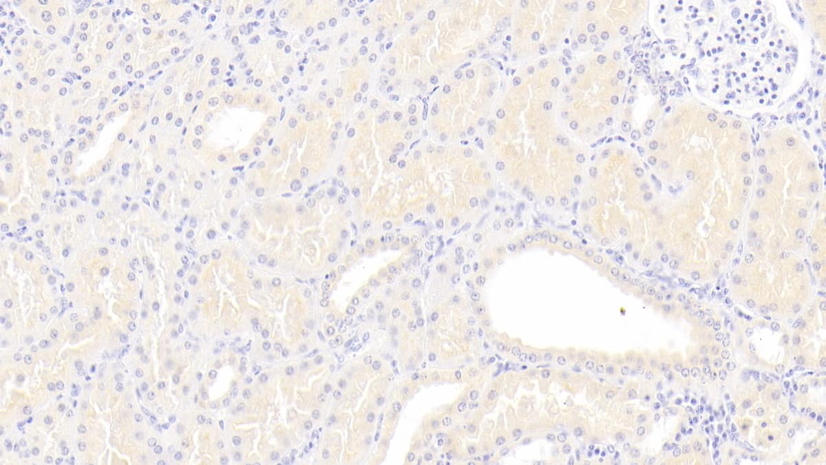 Immunohistochemistry-Paraffin Lipoprotein a Antibody