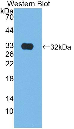 Western Blot: Kallikrein 9 Antibody [NBP3-42364] - Sample: Recombinant protein.
