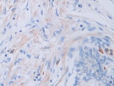 Immunohistochemistry-Paraffin: Cathepsin V Antibody [NBP3-42366] - DAB staining on IHC-P; Samples: Human Prostate Tissue; Primary Ab: 30ug/ml NBP3-42366; Second Ab: 2ug/mL HRP-Linked Caprine Anti-Rabbit IgG Polyclonal Antibody