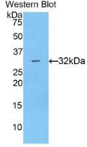 Western Blot: Cathepsin V Antibody [NBP3-42366] - Sample: Recombinant protein.