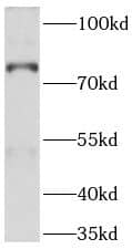 Western Blot: ABCD1 Antibody (9D11) [NBP3-42921] - HeLa cells were subjected to SDS PAGE followed by western blot with (ABCD1 antibody) at dilution of 1:400