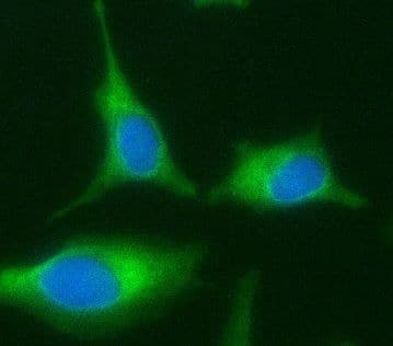 Immunocytochemistry/ Immunofluorescence: ABCD1 Antibody (9D11) [NBP3-42921] - Immunofluorescence analysis of Hela cells using (ABCD1 antibody) at dilution of 1:100. Blue: DAPI for nuclear staining.