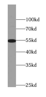 Western Blot: AEBP2 Antibody (9B3) [NBP3-42923] - HeLa cells were subjected to SDS PAGE followed by western blot with (AEBP2 antibody) at dilution of 1:1000