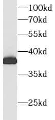 Western Blot: Aldolase C Antibody (6F3) [NBP3-42925] - human heart tissue were subjected to SDS PAGE followed by western blot with (Aldolase C antibody) at dilution of 1:10000