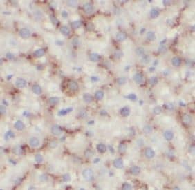 Immunohistochemistry: Aldolase C Antibody (6F3) [NBP3-42925] - Immunohistochemistry of paraffin-embedded human liver tissue slide using (Aldolase C Antibody) at dilution of 1:200 . heat mediated antigen retrieved with Tris-EDTA buffer(pH9).