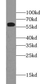 Western Blot: Pancreatic Amylase Alpha Antibody (1C7) [NBP3-42927] - human saliva were subjected to SDS PAGE followed by western blot with (Pancreatic Amylase Alpha antibody) at dilution of 1:2000