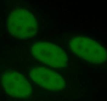 Immunocytochemistry/ Immunofluorescence: ANP32B Antibody (4F5) [NBP3-42928] - Immunofluorescent analysis of HepG2 cells using (ANP32B antibody) at dilution of 1:50 and Alexa Fluor 488-conjugated Goat Anti-Mouse IgG(H+L)