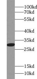 Western Blot: ANP32B Antibody (4F5) [NBP3-42928] - HEK-293 cells were subjected to SDS PAGE followed by western blot with (ANP32B Antibody) at dilution of 1:1000