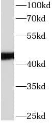 Western Blot: Apolipoprotein L1 Antibody (5E2) [NBP3-42929] - 1 ug human plasma tissue was subjected to SDS PAGE followed by western blot with (Apolipoprotein L1 Antibody) at dilution of 1:50000