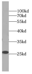 Western Blot: D4-GDI/RhoGDI2 Antibody (5A6) [NBP3-42930] - U-937 cells were subjected to SDS PAGE followed by western blot with (D4-GDI/RhoGDI2 antibody) at dilution of 1:1000