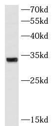 Western Blot: ATPG Antibody (8H11) [NBP3-42931] - human heart tissue were subjected to SDS PAGE followed by western blot with (ATPG Antibody) at dilution of 1:1000