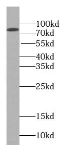 Western Blot BBS2 Antibody (9F10)