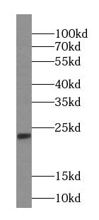 Western Blot: IMP3 Antibody (4D1) [NBP3-42933] - HeLa cells were subjected to SDS PAGE followed by western blot with (IMP3 Antibody) at dilution of 1:2000