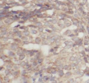 Immunohistochemistry IMP3 Antibody (4D1) - BSA Free