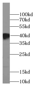 Western Blot BBS5 Antibody (7E11)