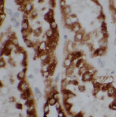 Immunohistochemistry BBS5 Antibody (7E11)