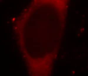 Immunocytochemistry/ Immunofluorescence: BORIS Antibody (2B10) [NBP3-42935] - Immunofluorescent analysis of MCF-7 cells, using (BORIS antibody) at 1:25 dilution andRhodamine-labeled goat anti-mouse IgG (red).