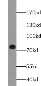 Western Blot: BORIS Antibody (2B10) [NBP3-42935] - HeLa cells were subjected to SDS PAGE followed by western blot with (BORIS antibody) at dilution of 1:1000