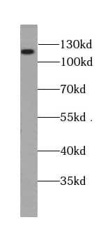 Western Blot: BRD8 Antibody (4B2) [NBP3-42936] - fetal human brain tissue were subjected to SDS PAGE followed by western blot with (BRD8 Antibody) at dilution of 1:1000