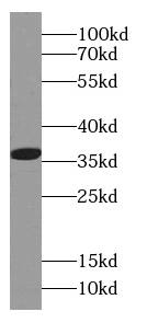 Western Blot: CAPZA1 Antibody (2C8) [NBP3-42937] - HeLa cells were subjected to SDS PAGE followed by western blot with (CAPZA1 antibody) at dilution of 1:1000