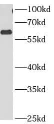 Western Blot: CCT3 Antibody (8C8) [NBP3-42938] - COLO 320 cells were subjected to SDS PAGE followed by western blot with (CCT3 antibody) at dilution of 1:1000