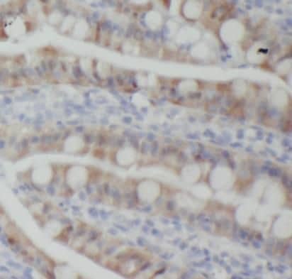 Immunohistochemistry: CD1d Antibody (1E3) [NBP3-42939] - Immunohistochemistry of paraffin-embedded human small intestine tissue slide using (CD1d Antibody) at dilution of 1:200