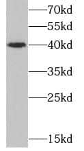 Western Blot: CD1d Antibody (1E3) [NBP3-42939] - human testis tissue were subjected to SDS PAGE followed by western blot with (CD1d Antibody) at dilution of 1:1000