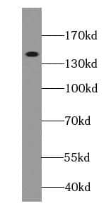 Western Blot: Ceruloplasmin Antibody (8F3) [NBP3-42940] - human placenta tissue were subjected to SDS PAGE followed by western blot with (Ceruloplasmin Antibody) at dilution of 1:1000