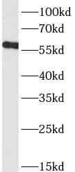 Western Blot: Nicotinic Acetylcholine R alpha 7/CHRNA7 Antibody (4B8) [NBP3-42941] - MCF-7cells were subjected to SDS PAGE followed by western blot with (Nicotinic Acetylcholine R alpha 7/CHRNA7 Antibody) at dilution of 1:1000