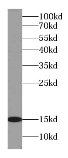 Western Blot: CISD2 Antibody (8A0) [NBP3-42942] - fetal human brain tissue were subjected to SDS PAGE followed by western blot with (CISD2 Antibody) at dilution of 1:8000