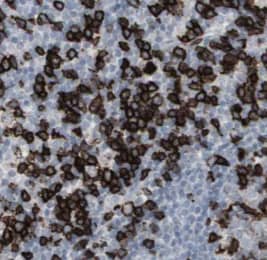 Immunohistochemistry: SCGF/CLEC11a Antibody (8C9) [NBP3-42943] - Immunohistochemistry of paraffin-embedded human lymphoma tissue slide using (SCGF/CLEC11a Antibody) at dilution of 1:50