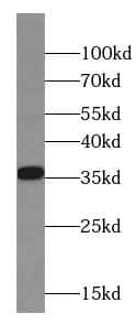 Western Blot: Calponin 2 Antibody (4C9) [NBP3-42944] - pig stomach tissue were subjected to SDS PAGE followed by western blot with (Calponin 2 Antibody) at dilution of 1:2000