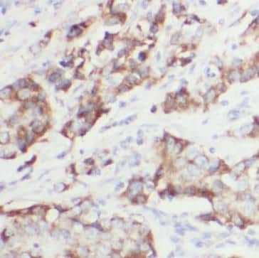 Immunohistochemistry: Calponin 2 Antibody (4C9) [NBP3-42944] - Immunohistochemistry of paraffin-embedded human breast hyperplasia tissue slide using (Calponin 2 Antibody) at dilution of 1:200 heat mediated antigen retrieved with Tris-EDTA buffer(pH9).