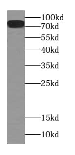 Western Blot: CPT1C Antibody (4E4) [NBP3-42946] - human brain tissue were subjected to SDS PAGE followed by western blot with (CPT1C antibody) at dilution of 1:500