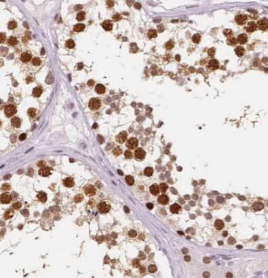 Immunohistochemistry: CPT1C Antibody (4E4) [NBP3-42946] - Immunohistochemistry of paraffin-embedded human testis using (CPT1C antibody) at dilution of 1:50