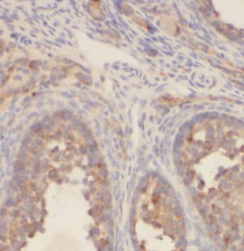 Immunohistochemistry CTAGE1 Antibody (4F3)