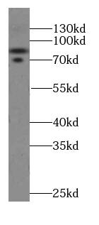 Western Blot Cullin 4a Antibody (5A7)