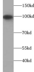 Western Blot: Isopeptidase T/USP5 Antibody (6G1) [NBP3-42952] - HeLa cells were subjected to SDS PAGE followed by western blot with (Isopeptidase T/USP5 Antibody) at dilution of 1:1000