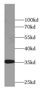 Western Blot: CYB5R3 Antibody (8H0) [NBP3-42953] - HepG2 cells were subjected to SDS PAGE followed by western blot with (CYB5R3 antibody) at dilution of 1:1000